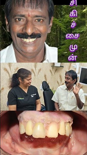 ஈரோட்டில் விட இங்க விலை குறைவு வலி இல்லாத சிகிச்சை Quality!என் நண்பனும் இங்கதான் சிகிச்சை பெற்றார்!