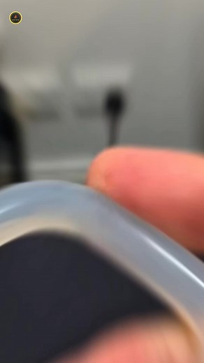 Pessary Ring #factsvideo #viralfact #science #disease #medicalfact #biology #Lifesaver #pessaryring | Crazy factor