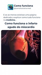 2.3K reactions · 177 shares |  Como funciona o Infarto Agudo do...