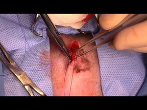 live stream vulvoplasty in a dog