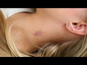 how to give a hickey top methods