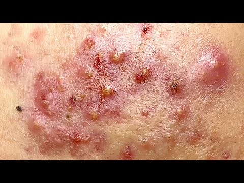 Relax Every Day With Sac Dep Spa #0160