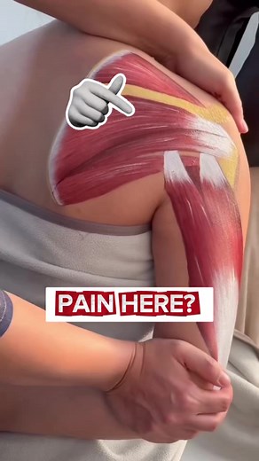 Effective Stretches to Alleviate Shoulder Pain
