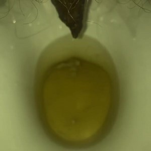 My girlfriend's poop 11