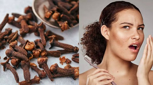 Are cloves good for oral health? Know its benefits, uses, and precautions