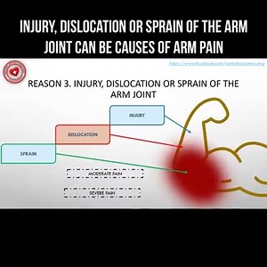 Injury, dislocation or sprain of the arm joint can be causes of arm pain #injury #dislocation #sprain | About health and science in simple words | Facebook