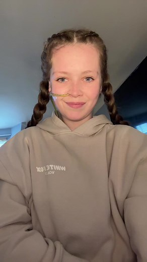 NG Tube Removal Journey: Watch My Experience