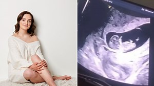 Millie Radford, 22, announces she’s pregnant with third baby in Instagram post