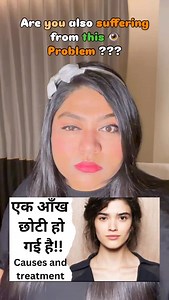 Facial muscle imbalance – One side of the face may be more active or tighter than the other. Sleeping on one side – Constant pressure on one side can affect eye shape over time. Eye strain or screen time – Overuse of one eye can cause temporary drooping or fatigue. Poor blood circulation or lymph blockage – Leads to puffiness or heaviness on one side. Posture imbalance – Neck or shoulder tightness can affect facial nerves and muscles. Eyebrow or eyelid muscle weakness – Causes one eye to appear