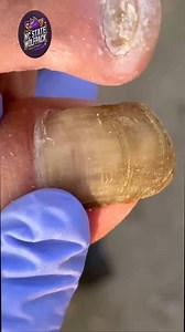 11K views · 74 reactions | Foot Comfort Support Tips for Diabetic Daily Care ️殺 #SeniorHealth #DiabeticFootCare #FootSupport | NC State Wolfpack on TheWolfpacker.com | Facebook