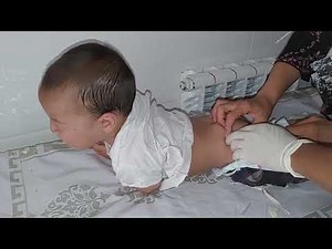 Injection Into The Baby's Buttock. IM INJECTION . Внутримышечный укол детям в ягодицу