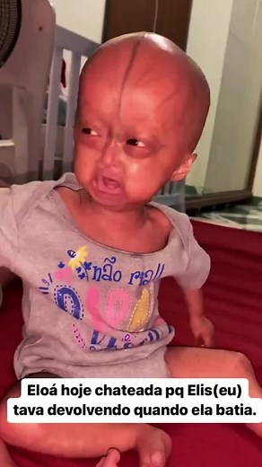 História de Elis e Eloá: Gêmeos e a Progeria