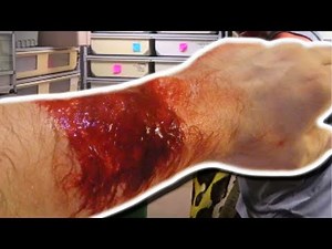 SNAKE BITES!!! CHEWYS BACK!!! | BRIAN BARCZYK