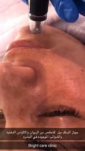 1.8K views · 14 reactions | Bright Care Clinic on Reels | Facebook