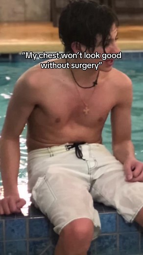 Mogging with my pectus excavatum is so easy #gymtok #fypシ #bodybuilder #pectusgang #pectusexcavatum?