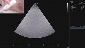 After watching this video, you’ll be able to display an optimized...