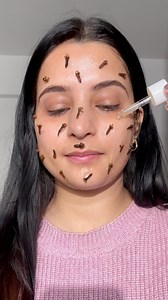 2.1M views · 20K reactions | Acne Removal Serum #acnetreatment #acneserum #diyserum #brightskin #skincaretips #beautyproducts | Imnehamandal | Facebook