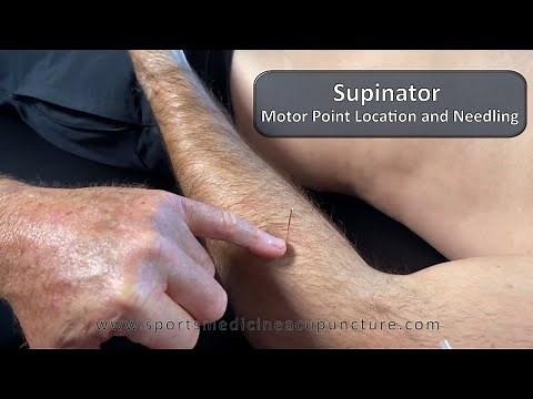 Supinator Muscle: Motor Point Location and Needle Technique