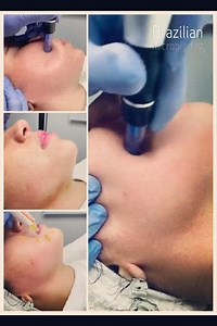 4.9K views · 34 reactions | Fresh start, needs Fresh & Healthy skin ✨ So our Derma pen session is the best for you! Book it now through: Heliopolis 01092196655 Tagmo3 "New Cairo" 01068946609 01144288448 Alex 01033505503 #BrazilianMicroblading #DermaPen | Brazilian Microblading | Facebook
