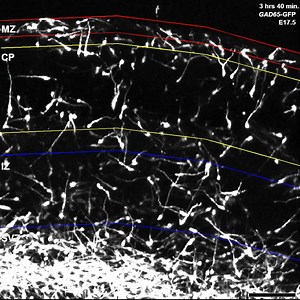 File:Early-life-serotonin-dysregulation-affects-the-migration-and-positioning-of-cortical-interneuron-tp2015147x3.ogv - Wikimedia Commons