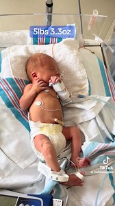 42K views · 2.9K reactions | This is what a 34-week-old baby looks like. It is legal to kill babies at this stage in many states. At least 10,000 late-term abortions happen every year. This is why we fight for Life. | Students for Life of America | Facebook