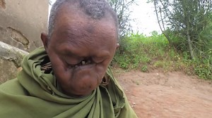 A WOMAN WITH NO FACE | BORN DIFFERENTLY | Jimbo Media