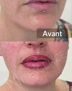 Nitescence on Reels | Facebook