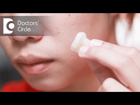 Toothpaste to treat Acne - Dr. Rasya Dixit