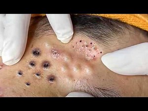 𝑺𝒐𝒐𝒕𝒉𝒊𝒏𝒈 𝑭𝒂𝒄𝒊𝒂𝒍 𝑻𝒓𝒆𝒂𝒕𝒎𝒆𝒏𝒕 𝑭𝒐𝒓 𝑺𝒕𝒓𝒆𝒔𝒔 𝑹𝒆𝒍𝒊𝒆𝒇 𝒂𝒕 𝑳𝒖𝒙𝒖𝒓𝒚 𝑺𝒑𝒂 𝑨𝒄𝒉𝒊𝒆𝒗𝒆 𝑰𝒏𝒏𝒆𝒓 𝑷𝒆𝒂𝒄𝒆 #2632523