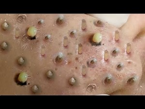 Relaxing Every Day With SKY SPA # 39