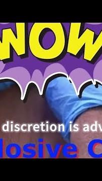 Cyst Explosion Pt 2 #exploding #pop #popping