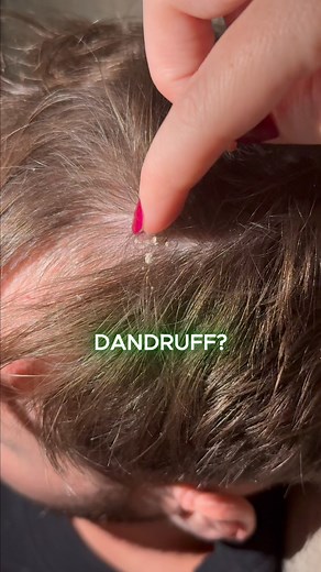 If your scalp is constantly flaking, itchy or oily - it’s not just “dry scalp.” It’s a sign your scalp barrier is out of balance. Sebum, yeast and inflammation all play a role in dandruff and dermatitis - and the key to calming it isn’t stripping the scalp… it’s restoring it. Here’s how to reset your scalp barrier 👇 1️⃣ Oil the scalp to soften buildup, soothe irritation and rebalance moisture. 2️⃣ Apply cream over affected areas to calm inflammation and relieve itching. 3️⃣ Leave on overnight f