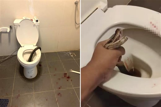 Man bitten in the testicles by 12-foot snake in bathroom worst nightmare: ‘Blood everywhere’