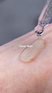 After prepping skin, treat multiple signs of congestion with our Balancing & Clarifying Serum. | The Ordinary