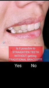 2.5K views · 31 reactions | Is it possible to straighten teeth...