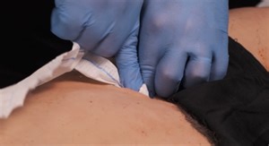 TMS Tuesday - Packing A Wound With OLAES Hemostatic Bandage | Soldier Systems Daily