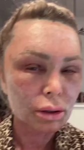 Fans stunned after Tamra Judge shows off plastic surgery | The US Sun - News