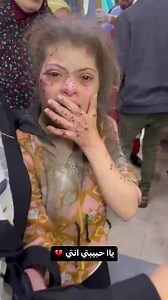 A Palestinian girl with Down syndrome survived a deadly Israeli airstrike in #Gaza. #Palestine #GazaUnderAttack | DOAM - Documenting Oppression Against Muslims