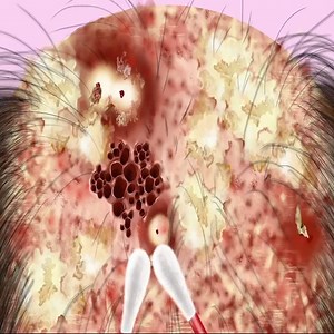 Warning 🐝 ASMR treatment of puffed face caused by honey bee sting healing a girl stung by a wasp | Asmr Treatment