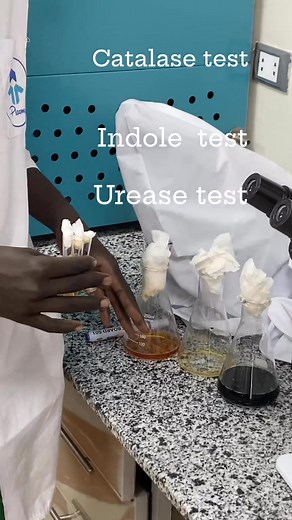 Catalase bubbles form after add hydrogen peroxide inducte a positive result Insole formation of red ring indicates positive results Urease formation of pink colour indicate urea hydrolysis | wol kiir chol Deng