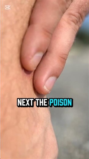 The Science of a Jellyfish Sting 🌊🧬⚡️