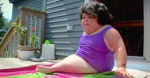 "Mermaid Girl" given days to live. 10 years later, her inspiring story proves doctors wrong