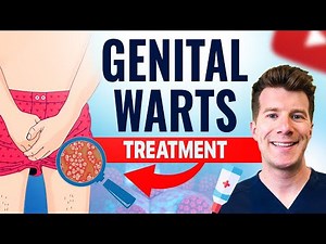 How to Treat HPV Genital Warts in Men