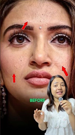 Celebrity skin transformation you never noticed