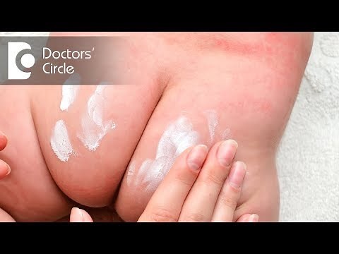 How to manage rashes on buttocks? - Dr. Rasya Dixit