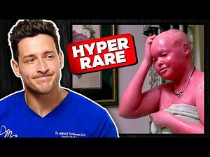 Doctor Reacts To Rarest Diseases