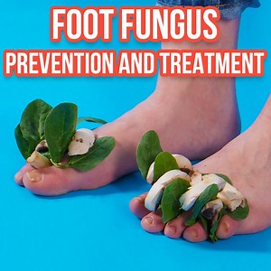 46K views · 18 reactions | Try these proven ways to prevent foot fungus. | Fabiosa Hearty | Facebook