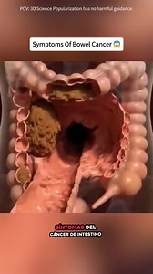 Medical 3D visualization for anatomy education.” Educational medical 3D animation For learning purposes only Non-graphic • Not real footage #medicaleducation #3danimation #anatomylearning #sciencevisuals #healthknowledge