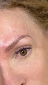 Do you identify with thin eyebrows and feel bothered by them? Microblading might be the perfect solution for you! Take a look at this result—flawed brows beautifully filled without losing their natural shape. Tell us your main questions about Microblading! We’re here to help. #BBMBrows #FlawlessBrows #BrowTransformation #BrowGoals #microbladingatlanta #eyebrow #inspiration #microblading #reels #transformation #georgia #atlanta #masterpiece #realhair #perfectbrows #realeyebrows | Brows by Milly