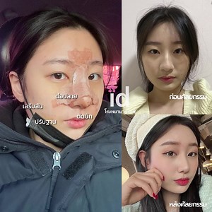 โรงพยาบาลศัลยกรรมไอดี - ID Hospital on Reels | Facebook